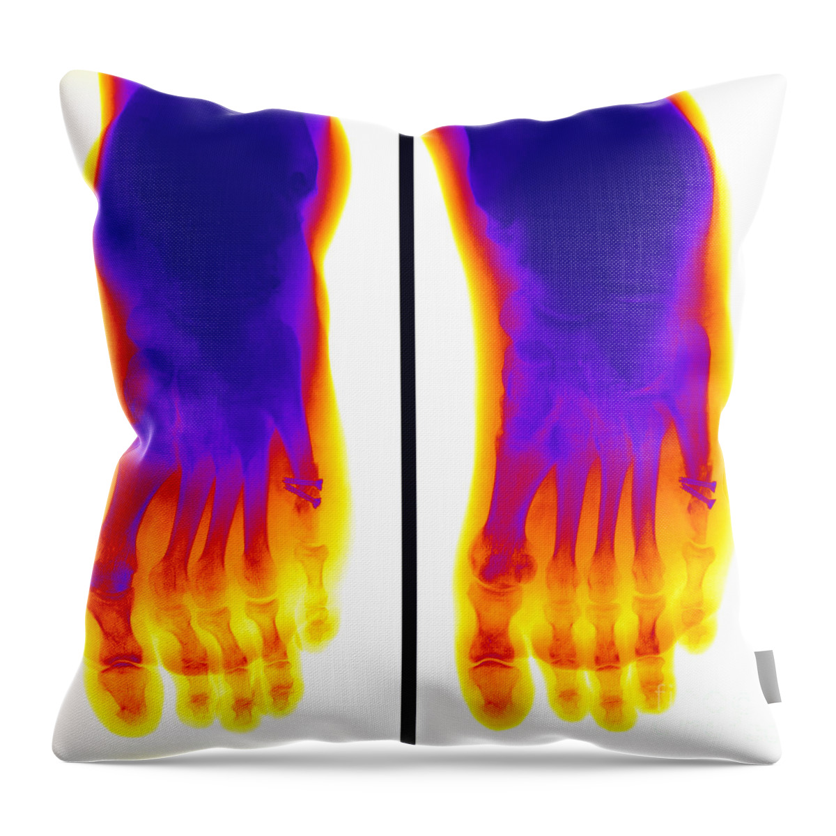 Metal Screw Throw Pillow featuring the photograph Broken Toe #1 by Ted Kinsman