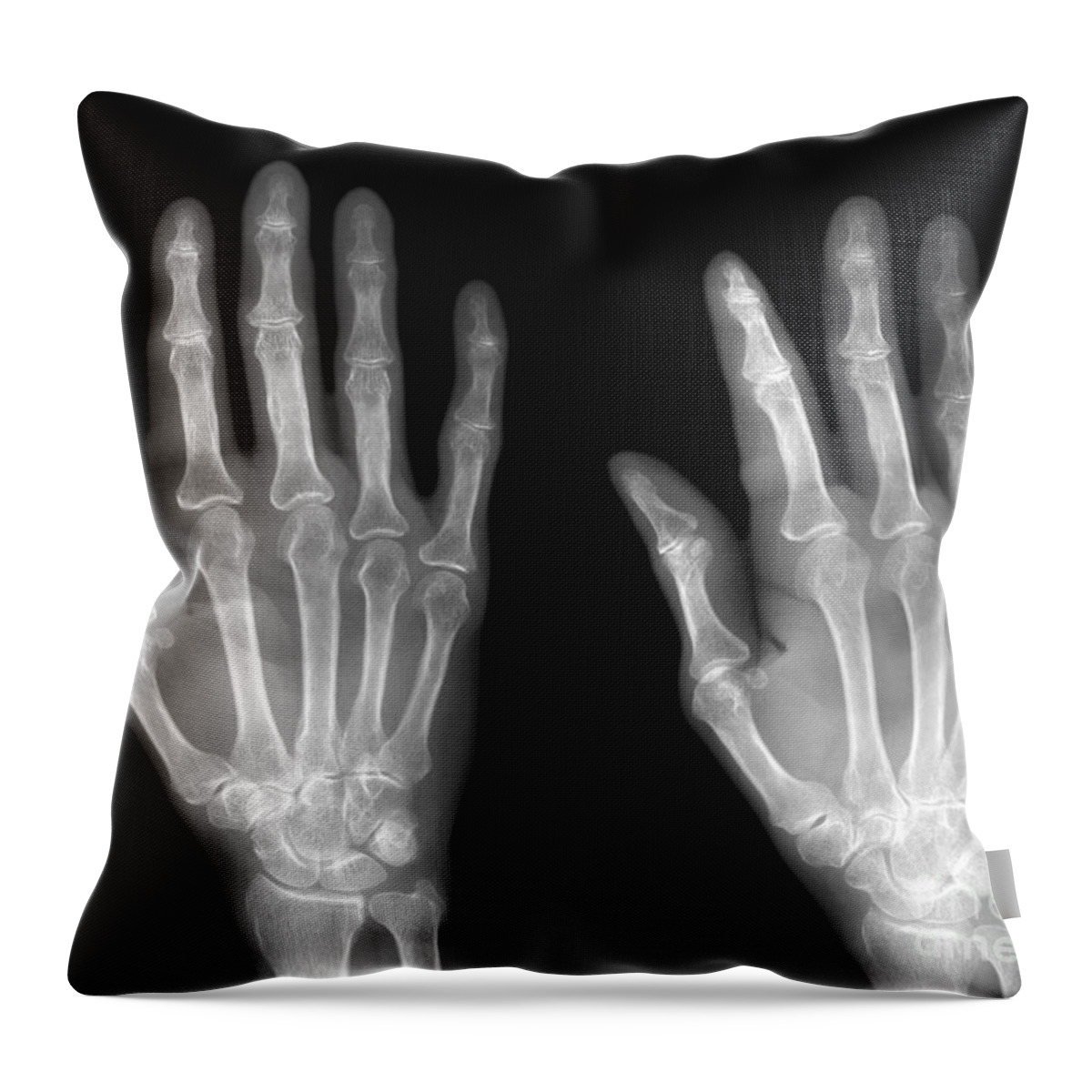 Hand Throw Pillow featuring the photograph Normal Hand #1 by Ted Kinsman