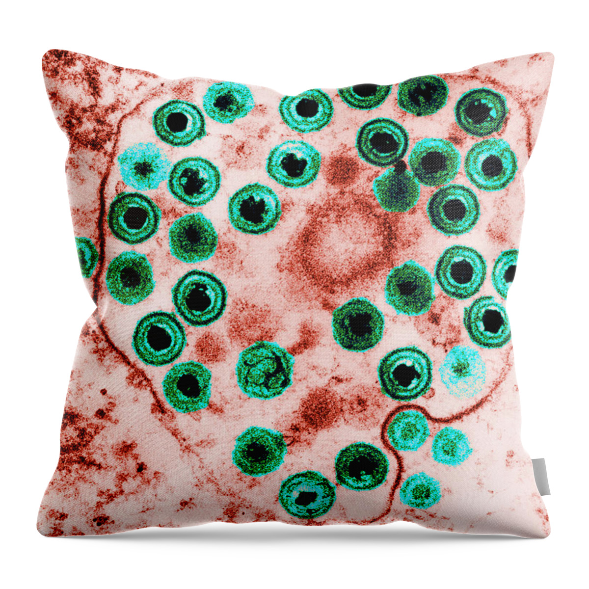 Disease Throw Pillow featuring the photograph Herpes #3 by Science Source