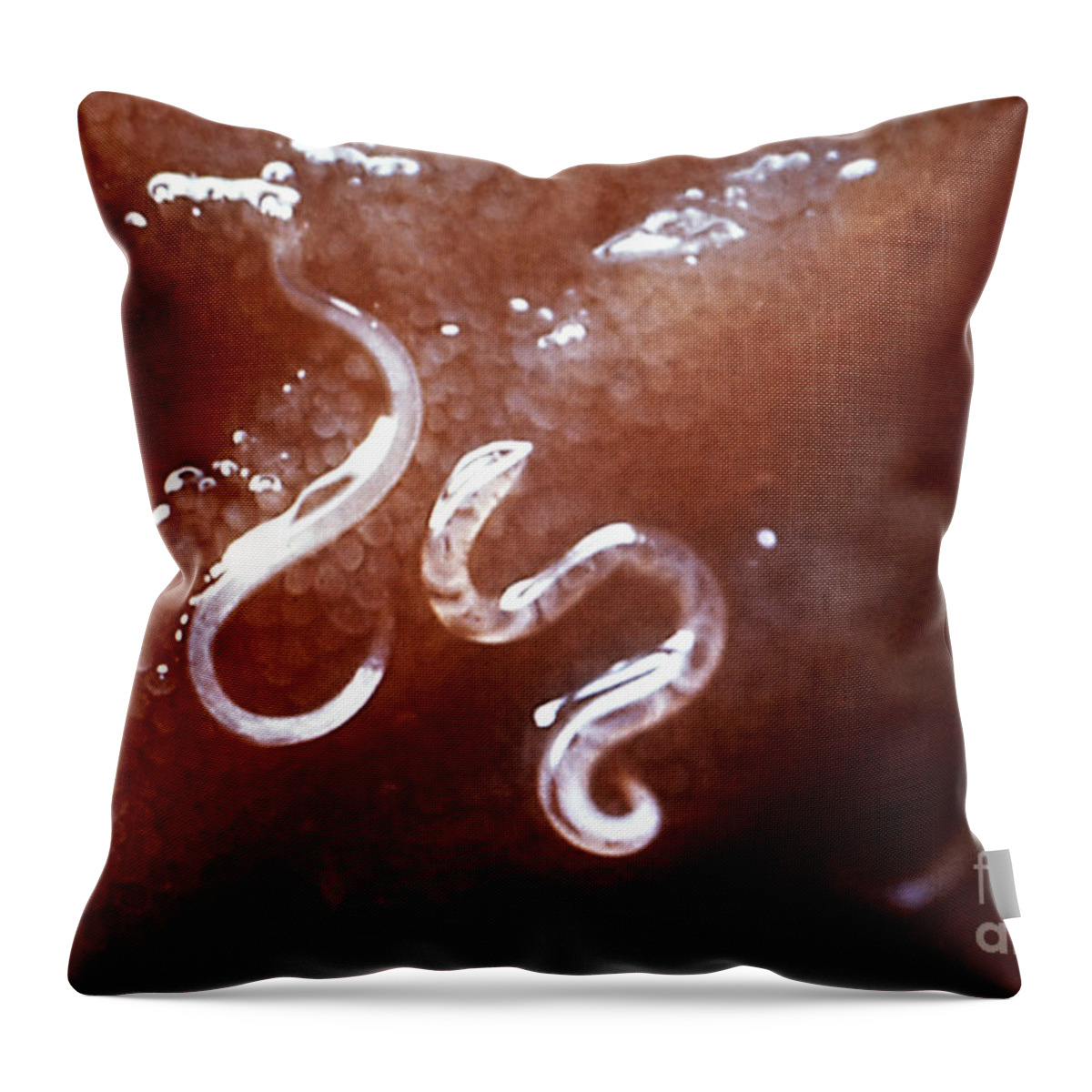 Ancylostoma Caninum Throw Pillow featuring the photograph Dog Hookworm by Science Source