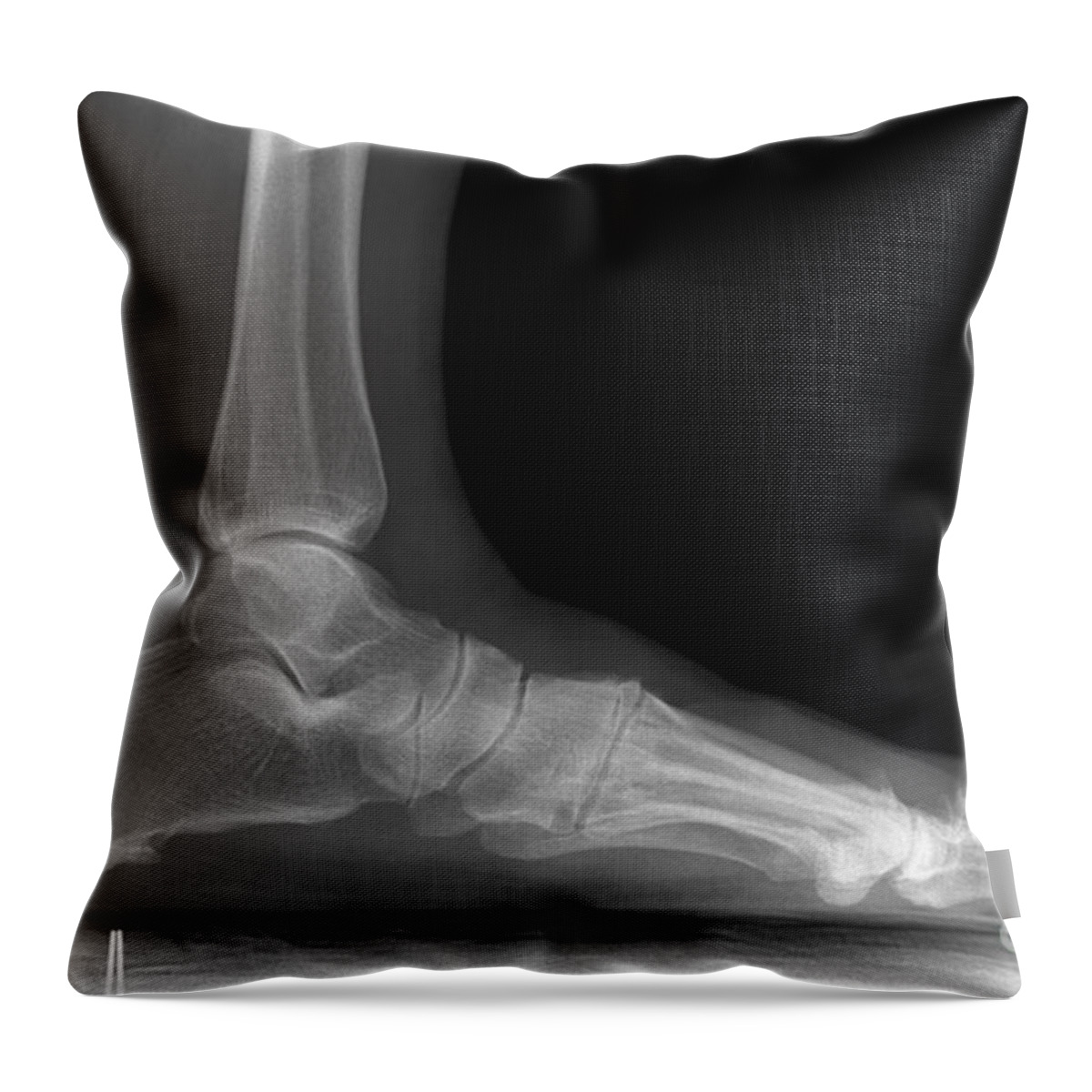 Joint Throw Pillow featuring the photograph Foot X-ray by Ted Kinsman