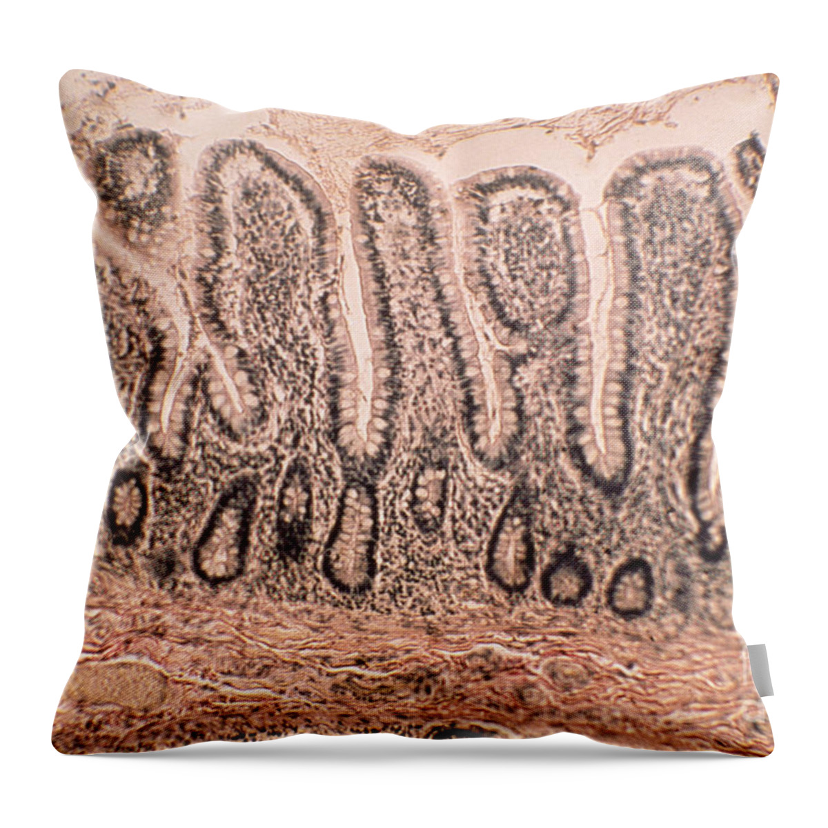 Histology Throw Pillow featuring the photograph Intestinal Villi Lm by Eric V. Grave