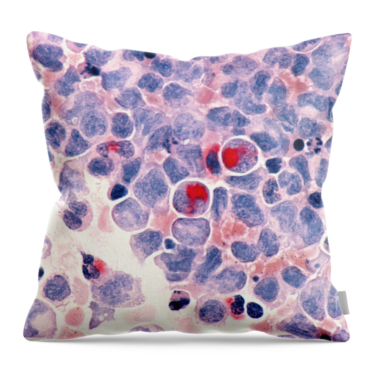 Myelocytic Leukemia Throw Pillow featuring the photograph Myelocytic Leukemia by Science Source