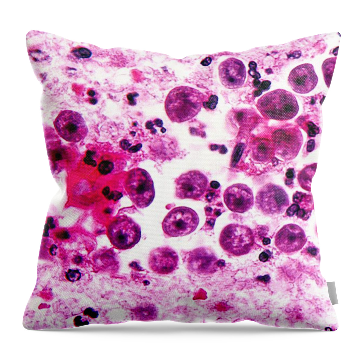 Micrograph Throw Pillow featuring the photograph Naegleria Fowleri, Lm by Science Source