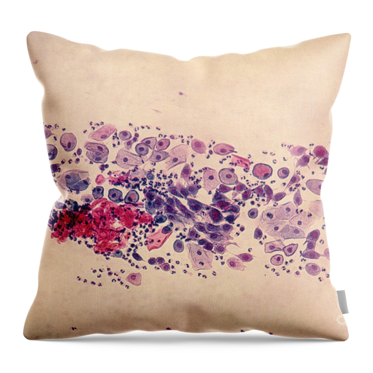 Medical Throw Pillow featuring the photograph Pap Smear, Parabasal Cells by Science Source