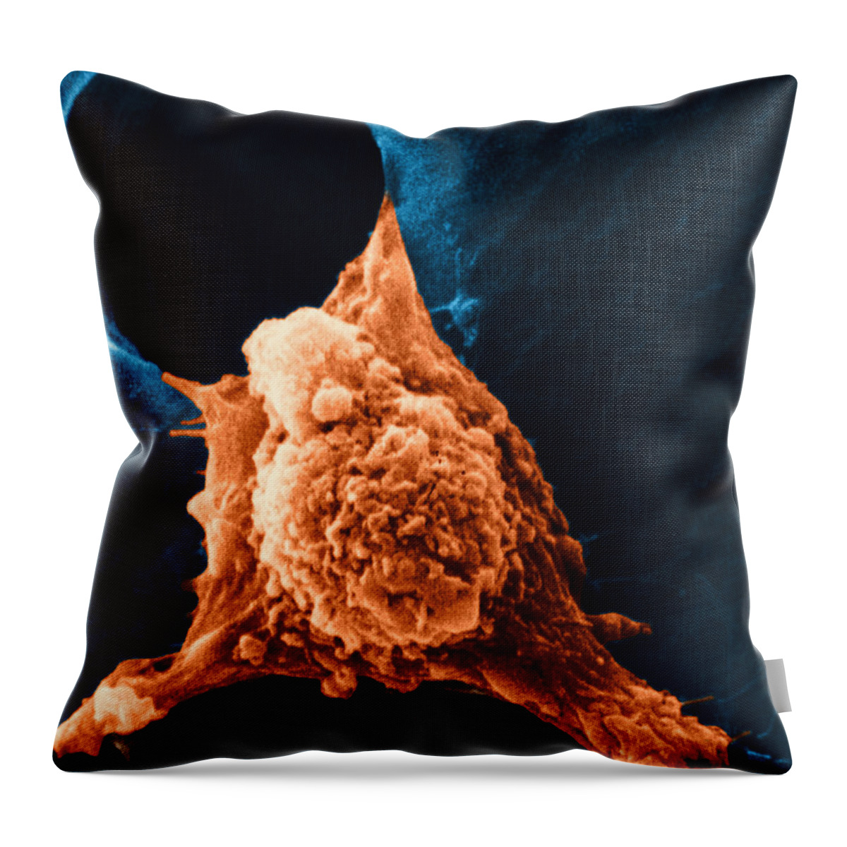 Sem Throw Pillow featuring the photograph Metastasis #3 by Science Source