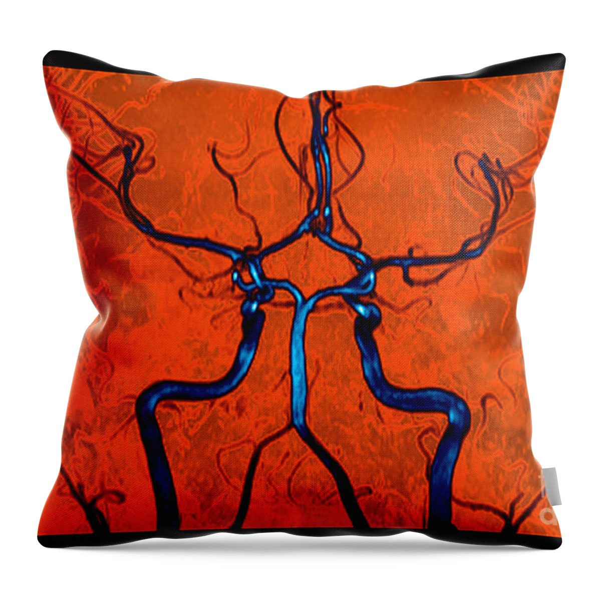 Mra Brain Throw Pillow featuring the photograph Normal Brain, Mra #1 by Living Art Enterprises