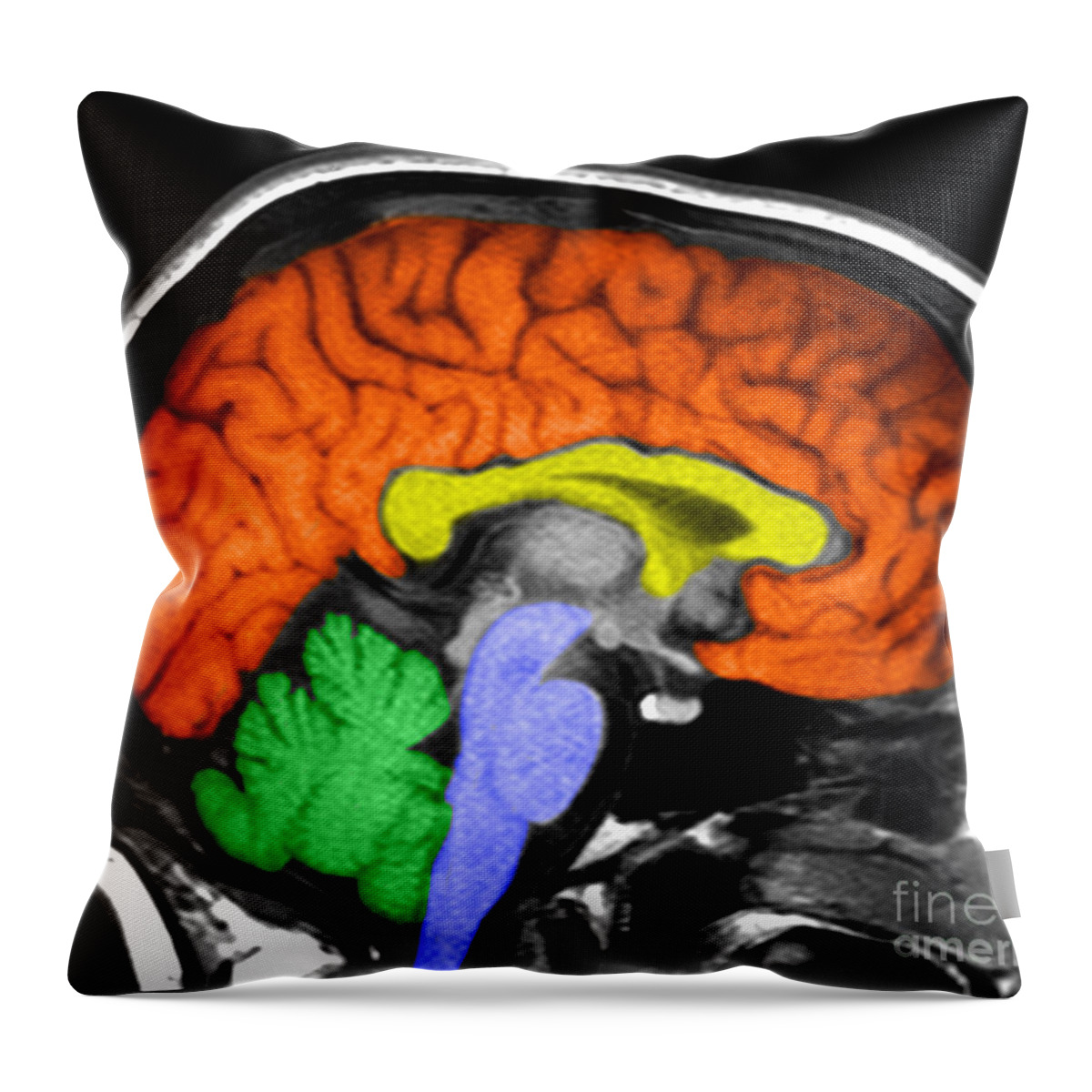 Medical Throw Pillow featuring the photograph Human Brain #10 by Ted Kinsman