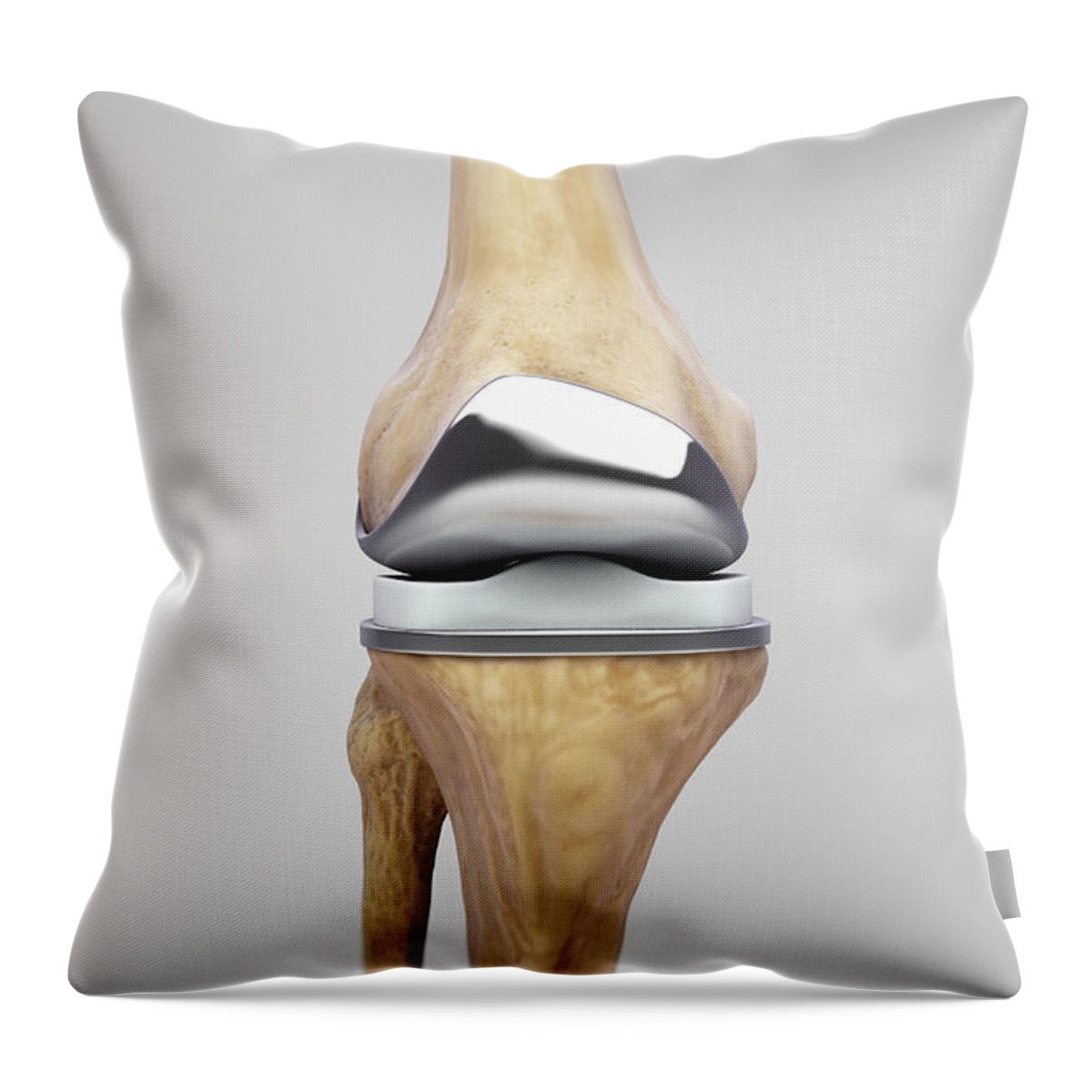 Digitally Generated Image Throw Pillow featuring the photograph Knee Replacement #11 by Science Picture Co