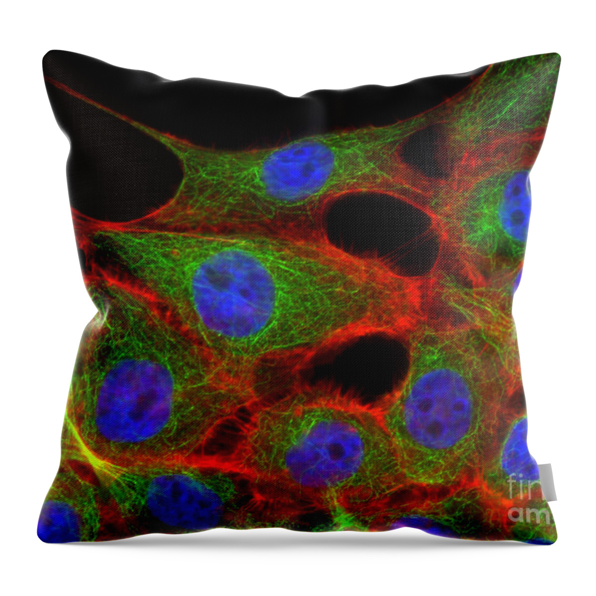 Science Throw Pillow featuring the photograph Breast Cancer Cells, Fm #2 by Science Source