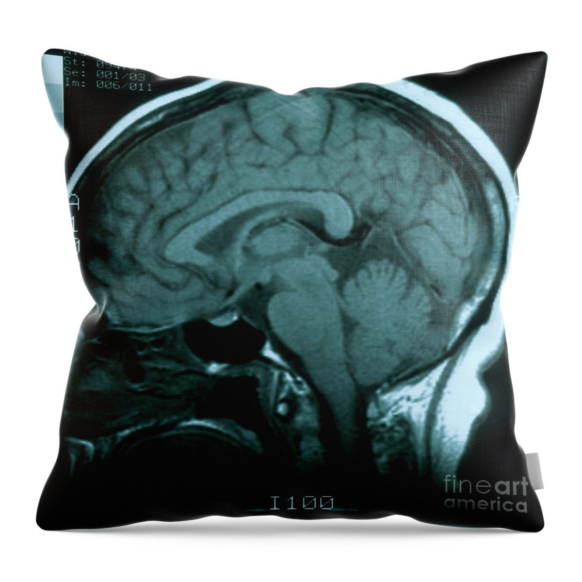 Brain Throw Pillow featuring the photograph Mri Of Normal Brain #2 by Science Source
