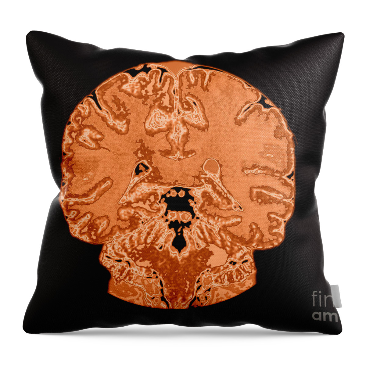 Brain Throw Pillow featuring the Coronal View Mri Of Normal Brain #3 by Medical Body Scans