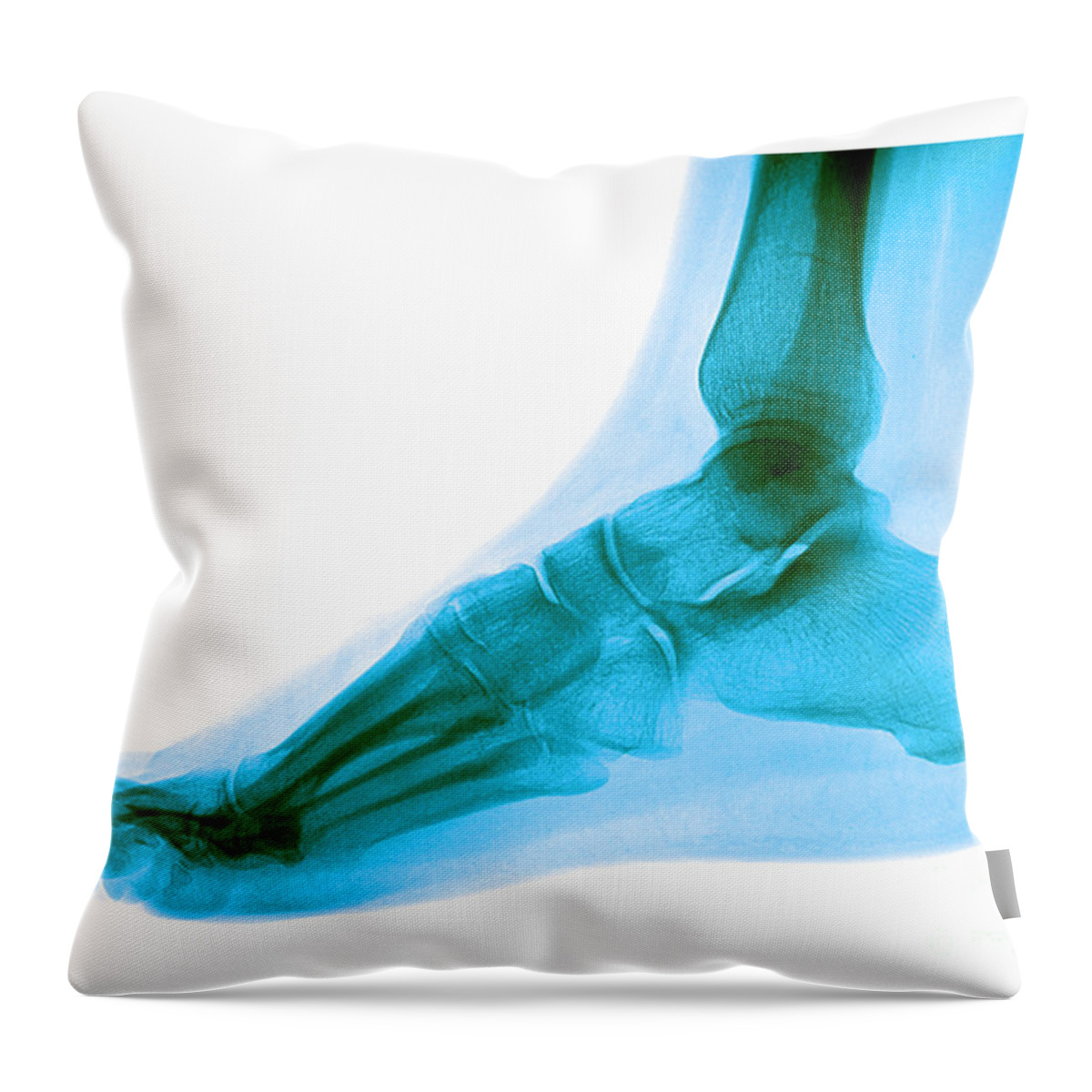 Anatomy Throw Pillow featuring the photograph Foot #4 by Medical Body Scans