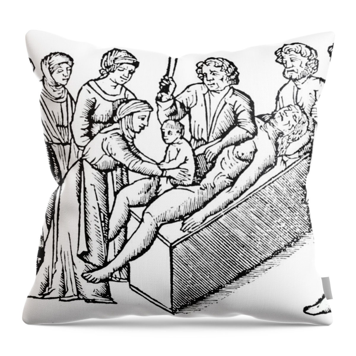 Medical Throw Pillow featuring the photograph Cesarean Section 16th Century by Science Source