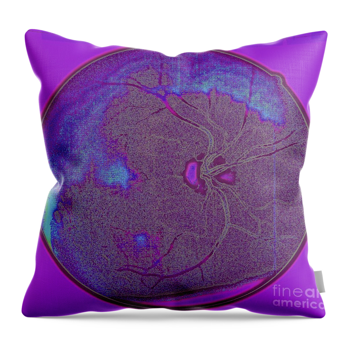 Eye Throw Pillow featuring the photograph Digital Art - Retinal Imaging by Mars Besso