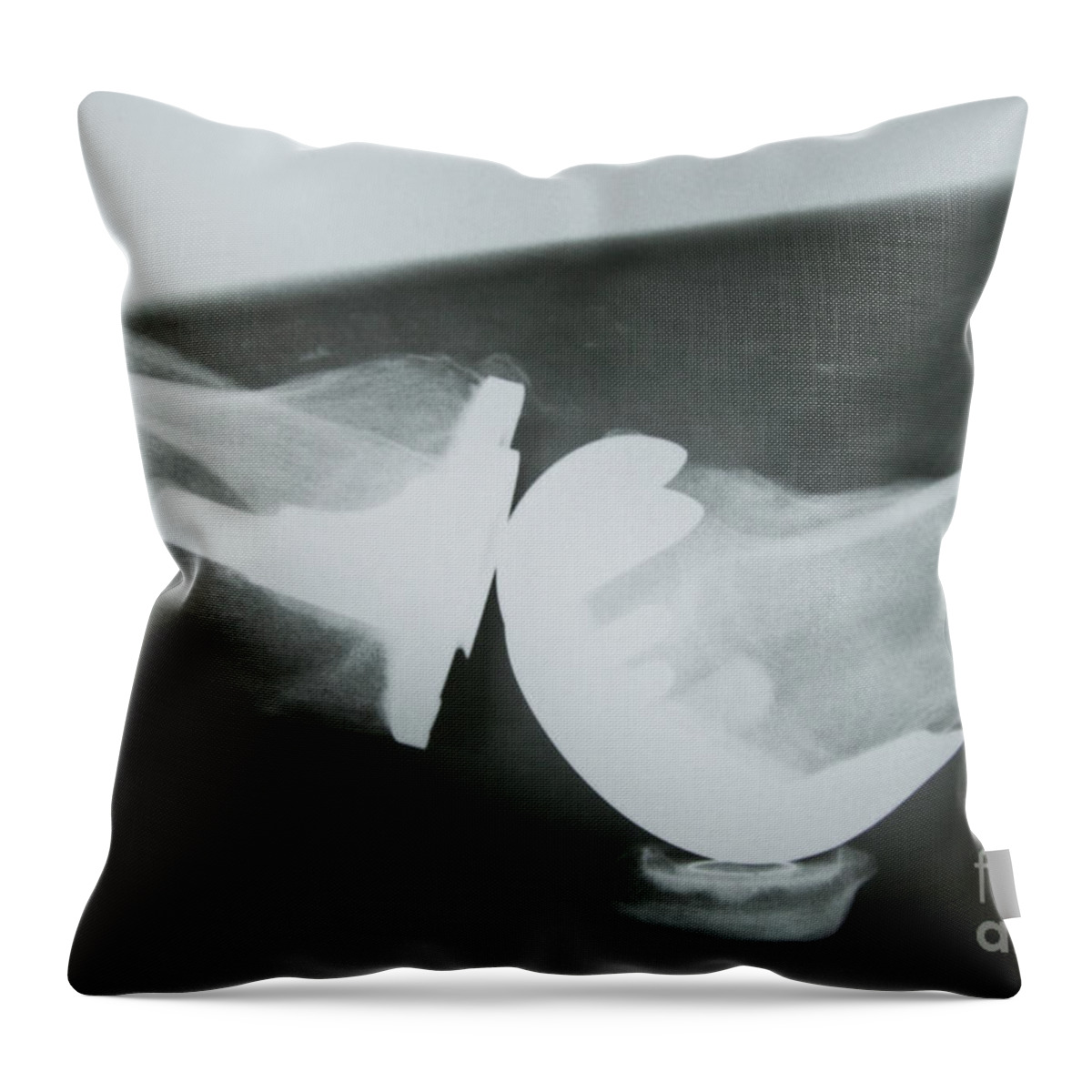X-ray Throw Pillow featuring the photograph Knee Replacement by Inga Spence