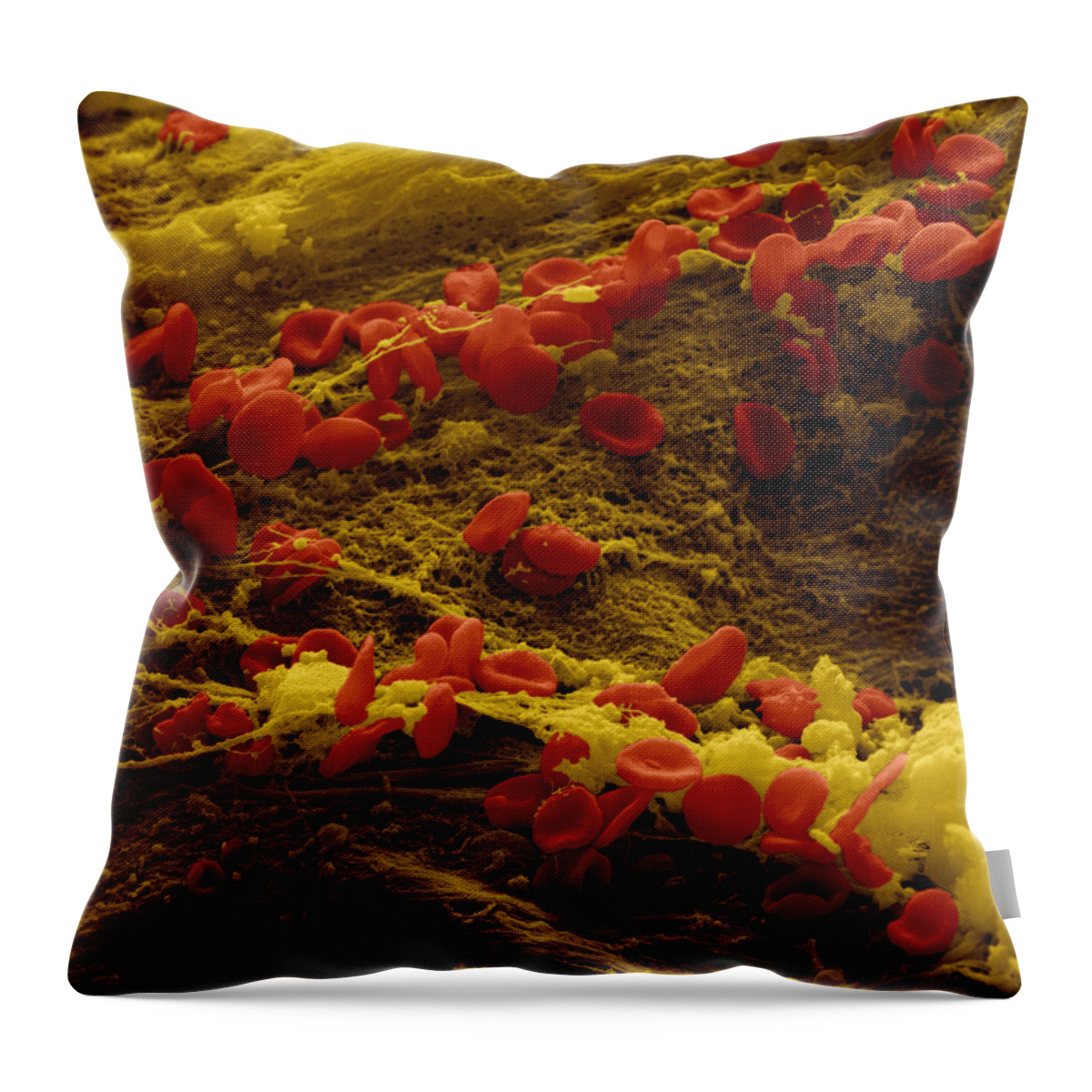 Blood Throw Pillow featuring the photograph Erythrocytes And Fibrin Threads #3 by Meckes/ottawa