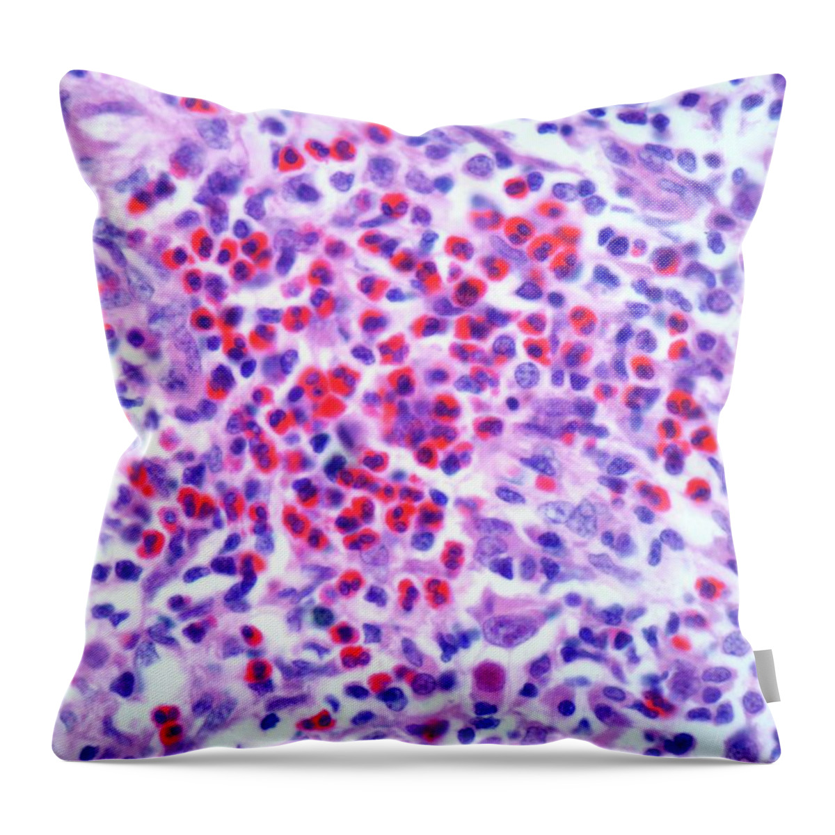 Anatomy Throw Pillow featuring the digital art Hodgkins Lymphoma, Light Micrograph by Science Photo Library - Steve Gschmeissner