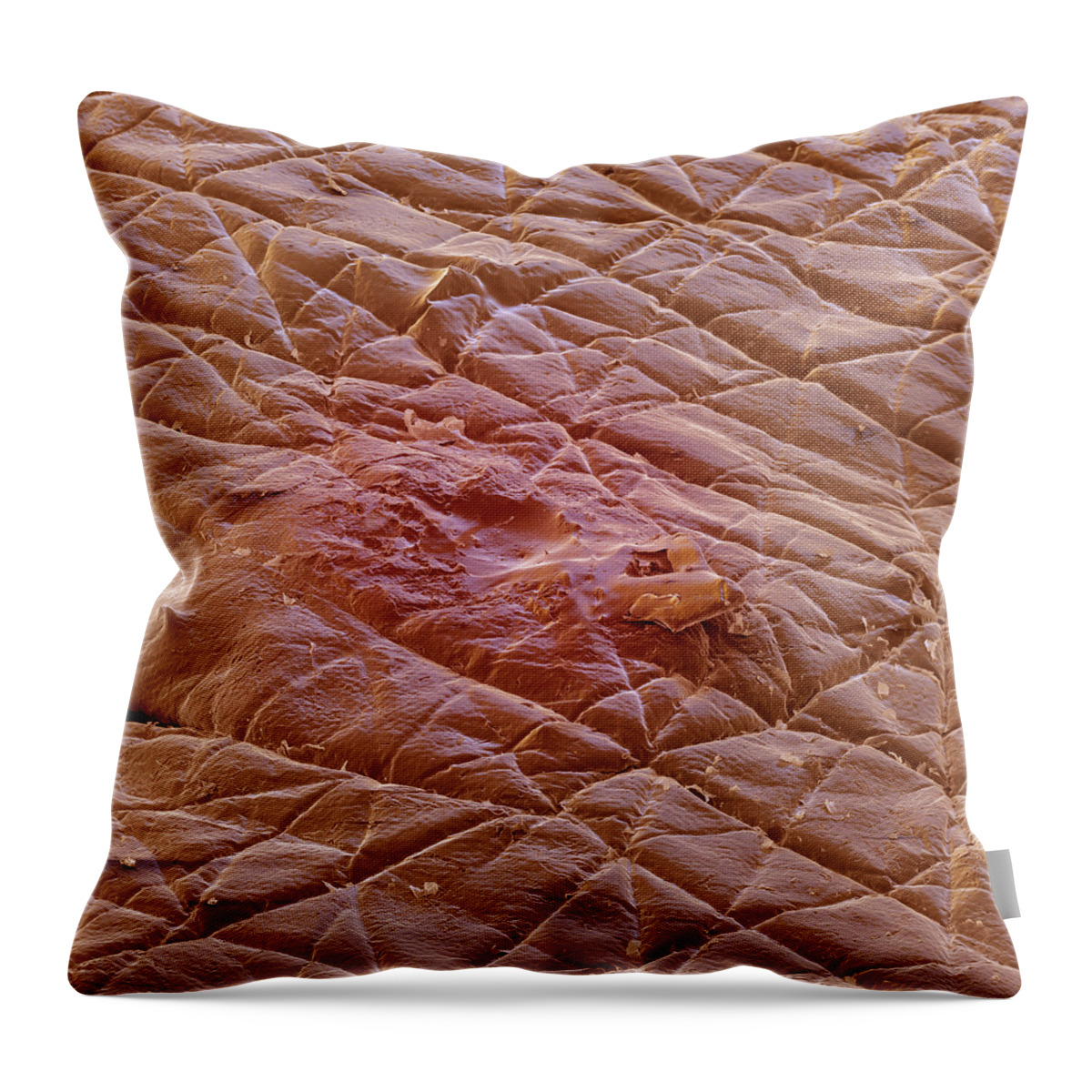 Acne Throw Pillow featuring the photograph Pimple by Meckes/ottawa