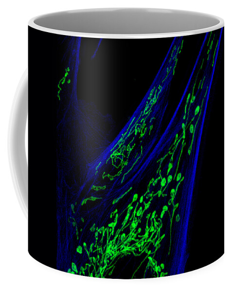 Bovine Coffee Mug featuring the photograph Bovine Pulmonary Artery Endothelial Cell #1 by Talley Lambert