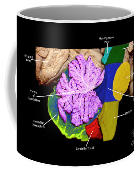 Human Coffee Mug featuring the photograph Brainstem, Cerebellum And Occipital Lobe #1 by Living Art Enterprises