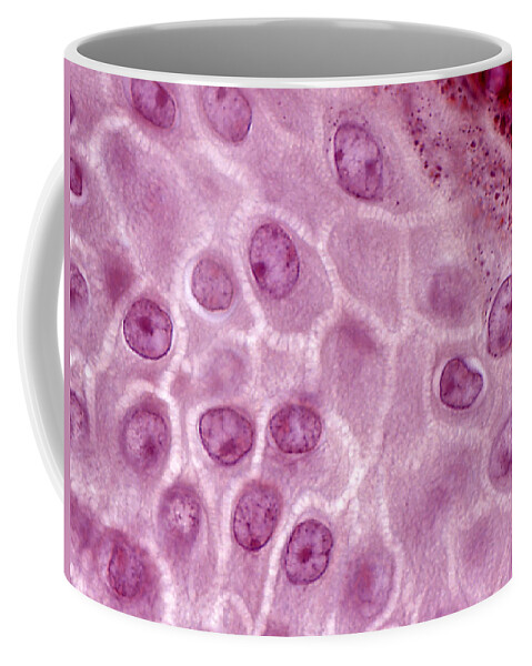 Skin Coffee Mug featuring the photograph Epidermis Lm #2 by Alvin Telser