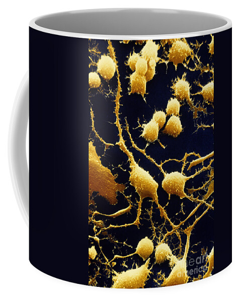 Axon Coffee Mug featuring the photograph Nerve Cells #1 by David M. Phillips