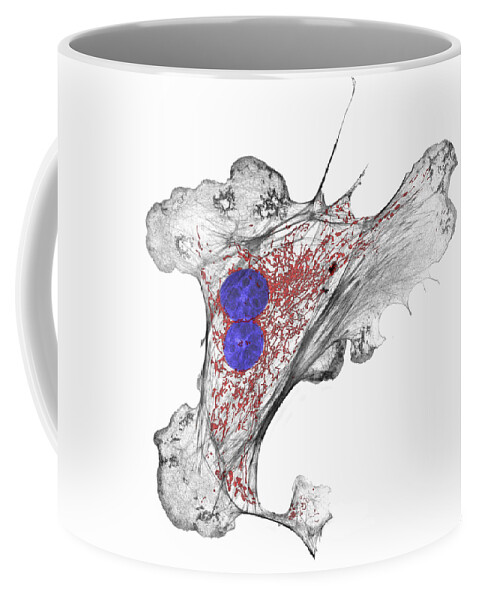 Bovine Coffee Mug featuring the photograph Binucleated Pulmonary Artery #2 by Talley Lambert