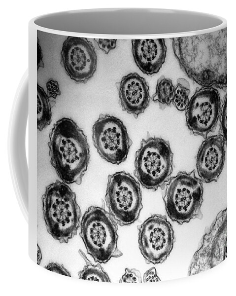 Transmission Electron Micrograph Coffee Mug featuring the photograph Human Sperm Tails, Tem #2 by David M. Phillips