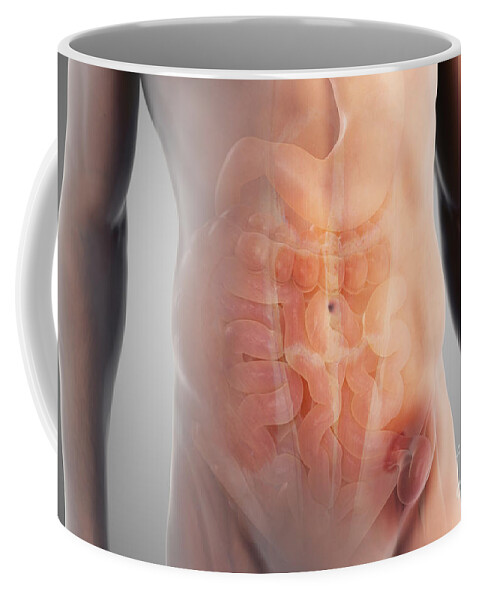 3d Visualisation Coffee Mug featuring the photograph Inguinal Hernia #2 by Science Picture Co