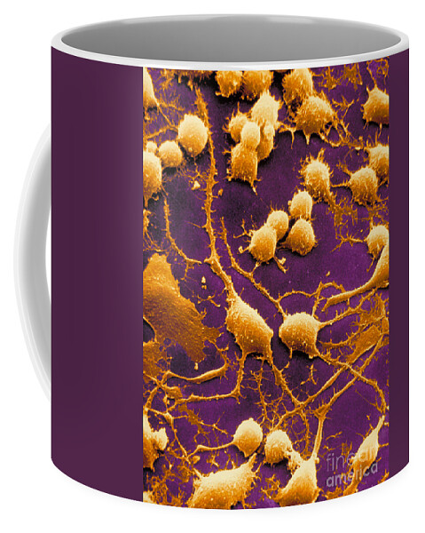 Dendrites Coffee Mug featuring the photograph Dendrites #3 by David M. Phillips / The Population Council
