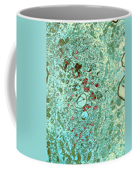 Transmission Electron Micrograph Coffee Mug featuring the photograph Group C Rna Tumor Virus Particles, Tem #3 by Science Source