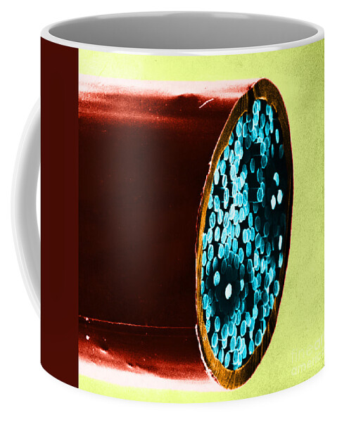 Science Coffee Mug featuring the photograph Dalkon Shield Iud Tailstring Sem #4 by David M. Phillips