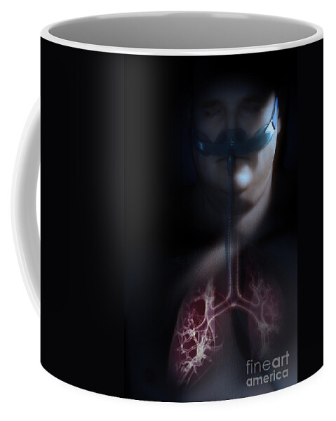 Bronchus Coffee Mug featuring the photograph Sleep Apnea #5 by Science Picture Co