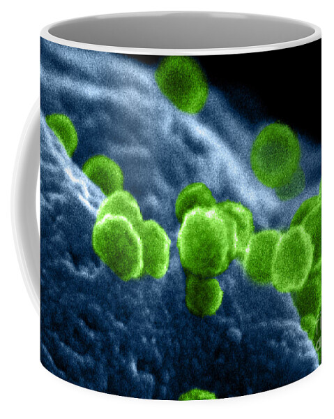 Science Coffee Mug featuring the photograph Aids Virus #7 by Dr Cecil H Fox