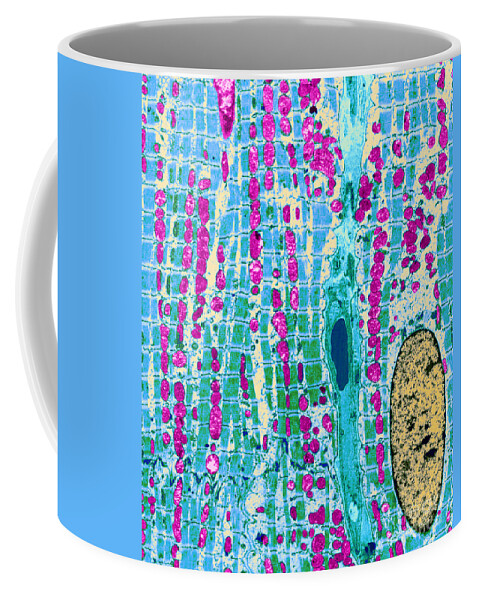 Histology Coffee Mug featuring the photograph Cardiac Muscle, Sarcomeres by Biophoto Associates