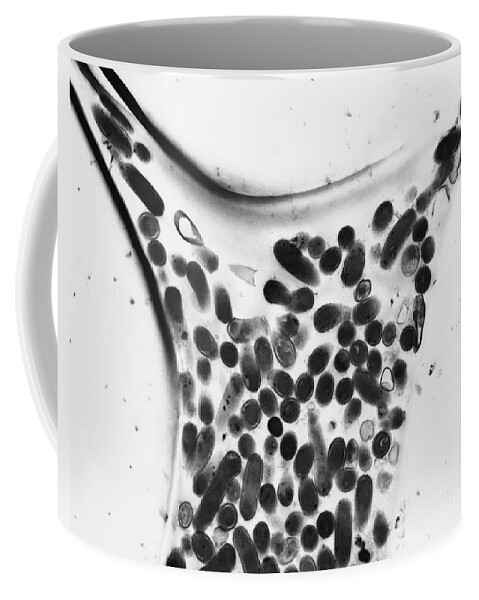 Medical Coffee Mug featuring the photograph Dalkon Shield Iud Tailstring by David M. Phillips