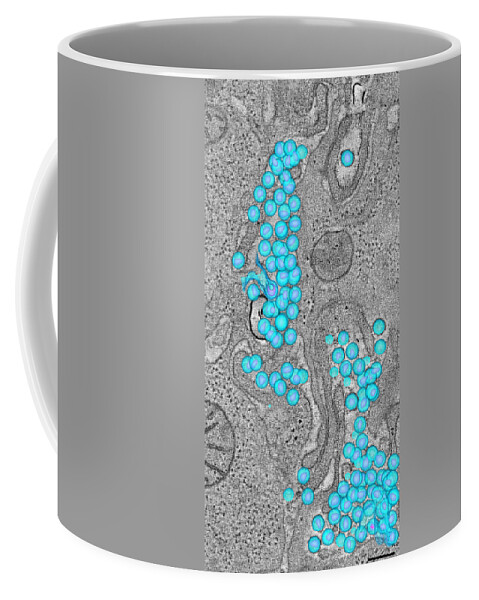 Science Coffee Mug featuring the photograph Hiv-1 Virus In Colon by Science Source
