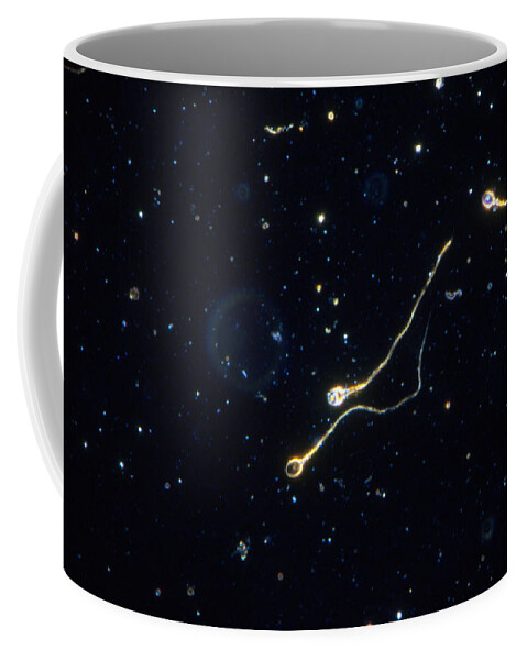 Cell Coffee Mug featuring the photograph Human Sperm, Dark Field Microscope by Michael Abbey