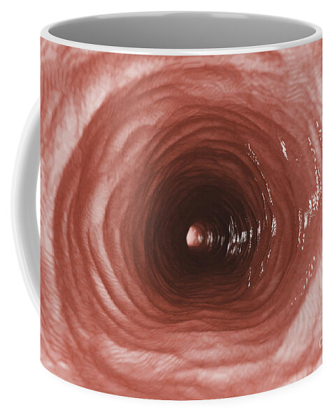 Abdomen Coffee Mug featuring the photograph Inner Esophagus by Science Picture Co