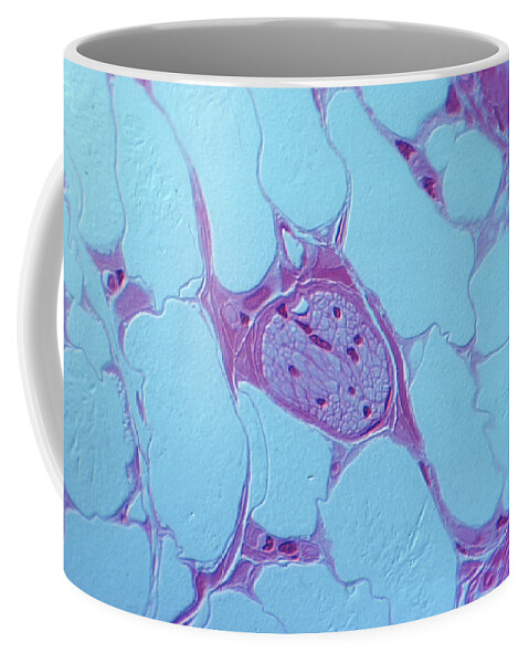 Adipocyte Coffee Mug featuring the photograph Nerve And Adipose Tissue by Joseph F. Gennaro Jr.