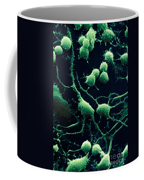 Dendrites Coffee Mug featuring the photograph Nerve Cells by David M. Phillips