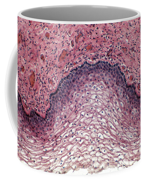Magnified Coffee Mug featuring the photograph Stratified Squamous Epithelium, Lm by Tierbild Okapia