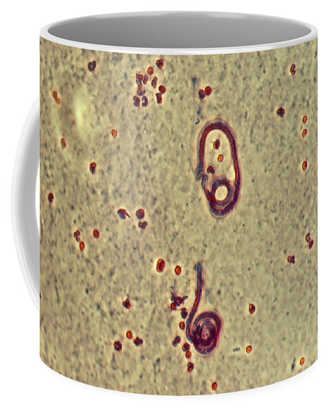 Wuchereria Bancrofti Coffee Mug featuring the photograph Wucheria Bancrofti, Parasite by Robert Knauft / Biology Pics