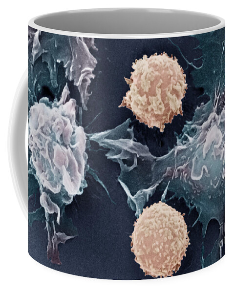 Cancer Coffee Mug featuring the photograph Cancer Cells #2 by Science Source