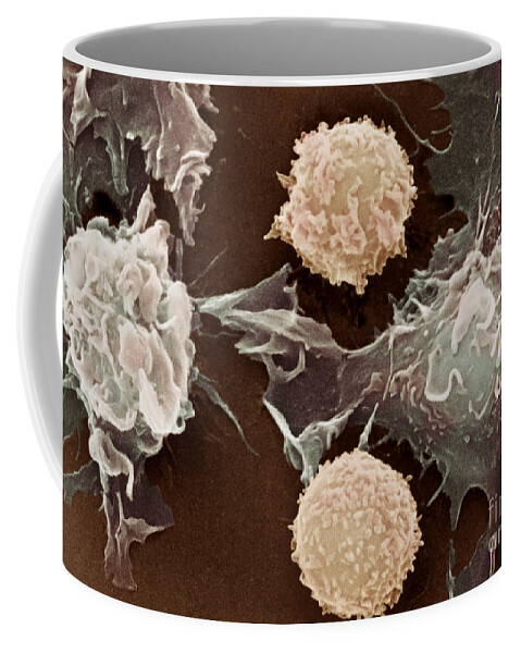 Cancer Coffee Mug featuring the photograph Cancer Cells #5 by Science Source