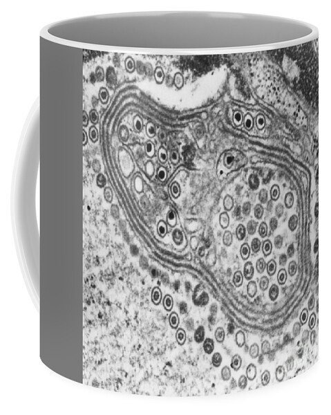Histopathology Coffee Mug featuring the photograph Herpes Simplex Virus, Tem #4 by Science Source
