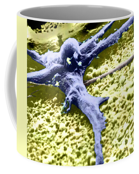 Cancer Coffee Mug featuring the photograph Malignant Cancer Cell #4 by Omikron