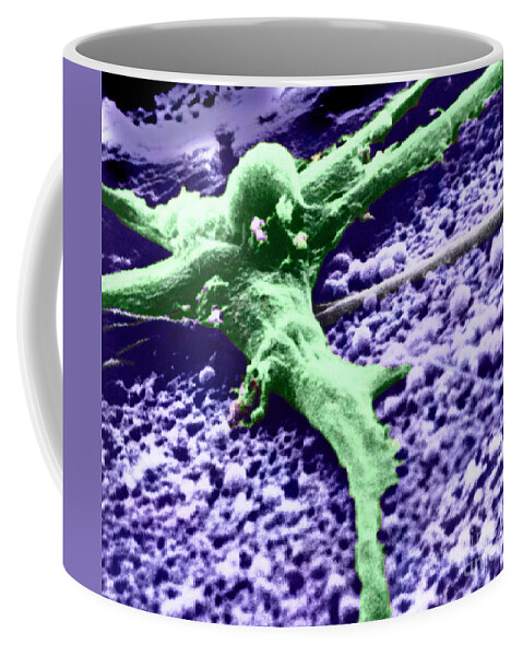 Cancer Coffee Mug featuring the photograph Malignant Cancer Cell #6 by Omikron