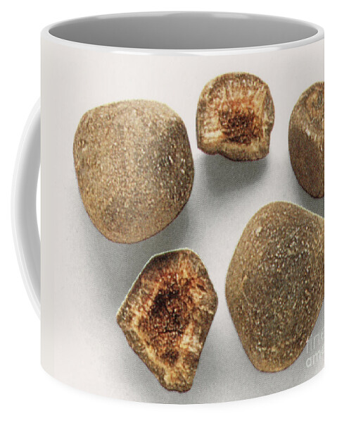 Historical Coffee Mug featuring the photograph Bezoar Stones by Science Source